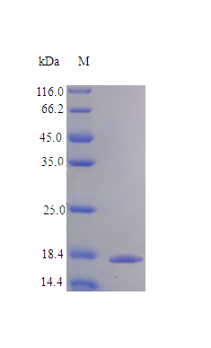 Recombinant Human Interleukin-1 receptor antagonist protein(IL1RN) (Active)