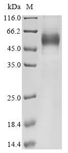 Recombinant Human Interleukin-13(IL13)