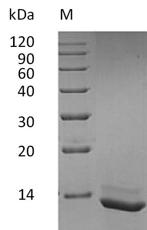 Recombinant Human Interleukin-15(IL15) (Active)