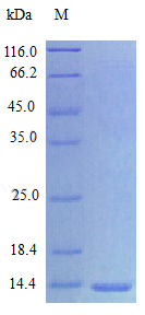 Recombinant Human Interleukin-15 protein(IL15) (Active)