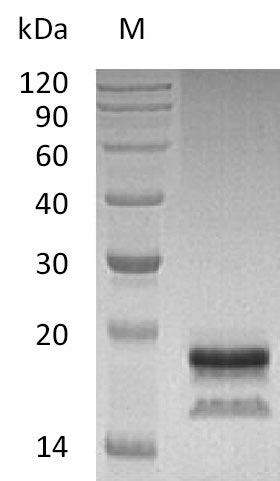Recombinant Human Interleukin-17A(IL17A) (Active)