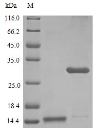 Recombinant Human Interleukin-17A protein(IL17A) (Active)