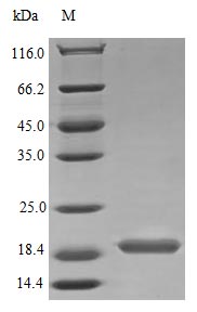 Recombinant Human Interleukin-17B protein(IL17B) (Active)