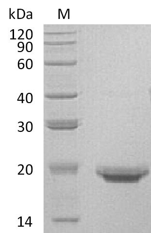 Recombinant Human Interleukin-17F(IL17F) (Active)