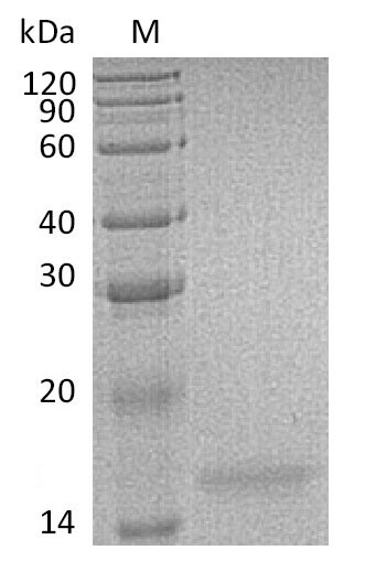 Recombinant Human Interleukin-17F(IL17F) (Active)
