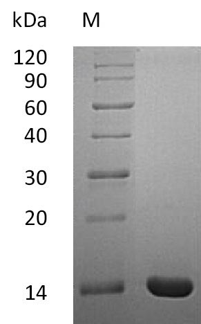 Recombinant Human Interleukin-2(IL2) (Active)