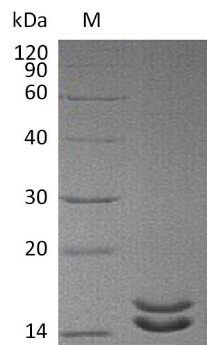 Recombinant Human Interleukin-2(IL2),Partial (Active)