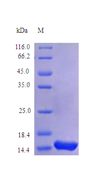 Recombinant Human Interleukin-21 protein(IL21) (Active)