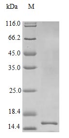 Recombinant Human Interleukin-22 protein(IL22) (Active)