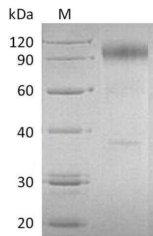 Recombinant Human Interleukin-23 receptor(IL23R),partial (Active)