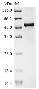 Recombinant Human Interleukin-27 subunit beta(EBI3),partial