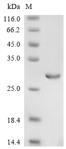 Recombinant Human Interleukin-28 receptor subunit alpha(IFNLR1),partial