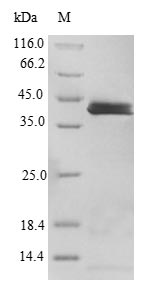 Recombinant Human Interleukin-36 alpha(IL36A)