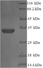 Recombinant Human Interleukin-36 receptor antagonist protein(IL36RN)