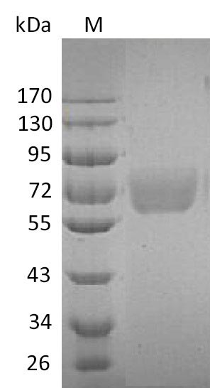 Recombinant Human Interleukin-4 receptor subunit alpha(IL4R),partial (Active)