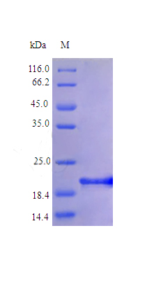 Recombinant Human Interleukin-6 protein(IL6) (Active)