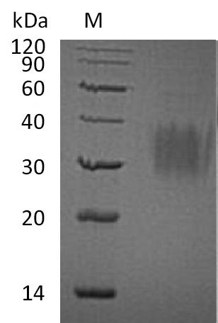 Recombinant Human Interleukin-9(IL9) (Active)