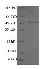 Recombinant Human Interstitial collagenase(MMP1),partial
