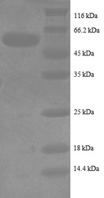 Recombinant Human Intestinal-type alkaline phosphatase(ALPI),partial