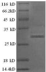 Recombinant Human Islet amyloid polypeptide(IAPP),partial