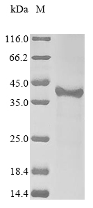 Recombinant Human Izumo sperm-egg fusion protein 1(IZUMO1),partial