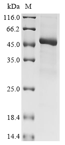 Recombinant Human Kelch domain-containing protein 3(KLHDC3)