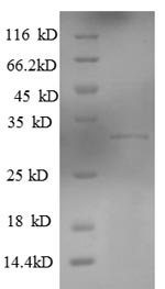 Recombinant Human Killer cell lectin-like receptor subfamily G member 1(KLRG1),partial
