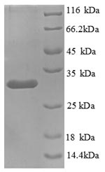 Recombinant Human Kininogen-1(KNG1),partial