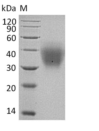 Recombinant Human Kit ligand(KITLG),partial (Active)