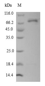 Recombinant Human L-dopachrome tautomerase (DCT),Partial