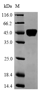 Recombinant Human Laminin subunit alpha-5(LAMA5),partial