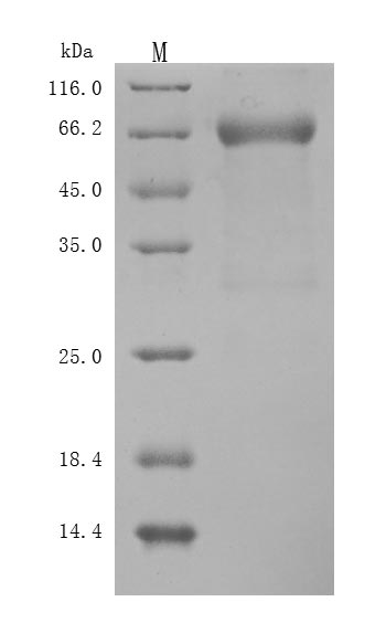 Recombinant Human Leukemia inhibitory factor(LIF) (Active)