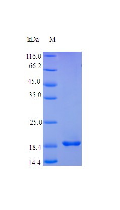 Recombinant Human Leukemia inhibitory factor protein(LIF) (Active)