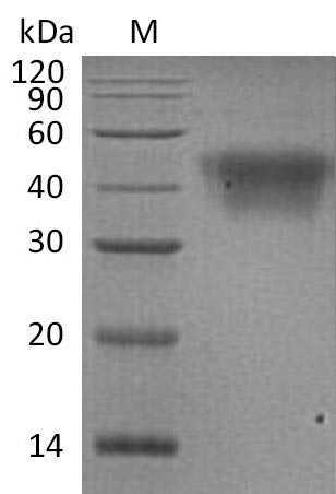 Recombinant Human Low affinity immunoglobulin gamma Fc region receptor III-A(FCGR3A),partial (Active)