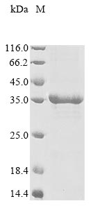 Recombinant Human Ly6/PLAUR domain-containing protein 3(LYPD3)