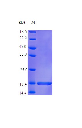 Recombinant Human Lymphotoxin-alpha protein(LTA) (Active)