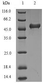 Recombinant Human Lys-63-specific deubiquitinase BRCC36(BRCC3)