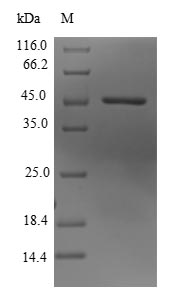 Recombinant Human Lysine-specific demethylase 3B(KDM3B) ,partial