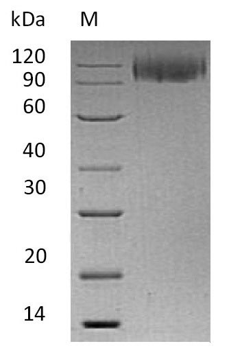 Recombinant Human Lysosome-associated membrane glycoprotein 1(LAMP1),partial (Active)