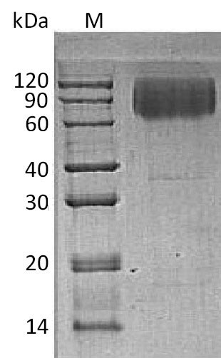 Recombinant Human Lysosome-associated membrane glycoprotein 2(LAMP2),partial (Active)