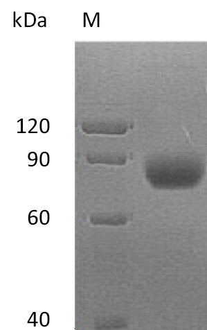 Recombinant Human MHC class I polypeptide-related sequence A(MICA),partial (Active)