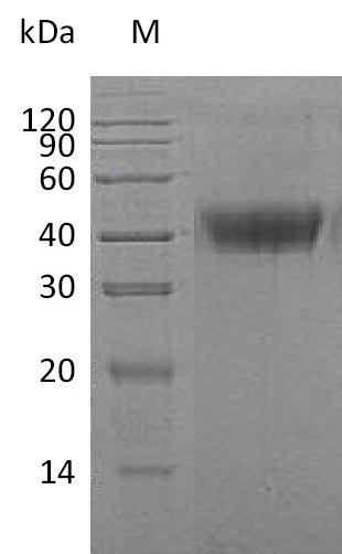 Recombinant Human Macrophage colony-stimulating factor 1(CSF1),partial (Active)
