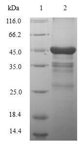 Recombinant Human Macrophage metalloelastase(MMP12)