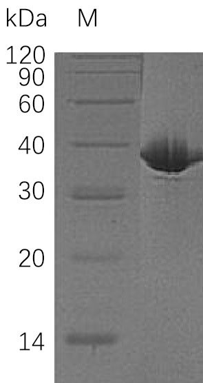 Recombinant Human Malate dehydrogenase, cytoplasmic(MDH1) (Active)