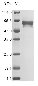 Recombinant Human Matrilin-3(MATN3)