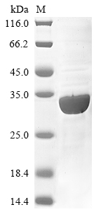 Recombinant Human Membrane-associated phosphatidylinositol transfer protein 3(PITPNM3),partial