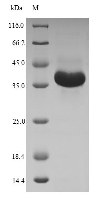 Recombinant Human Membrane-bound transcription factor site-1 protease(MBTPS1),partial
