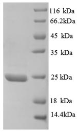 Recombinant Human Metalloproteinase inhibitor 3(TIMP3),partial