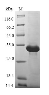 Recombinant Human Metallothionein-3(MT3)