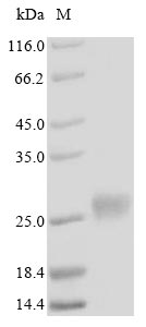 Recombinant Human Metallothionein-4(MT4)